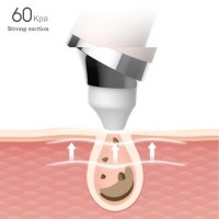 Аппарат для чистки лица GOODtime Pick Up Visual Blackhead Remover