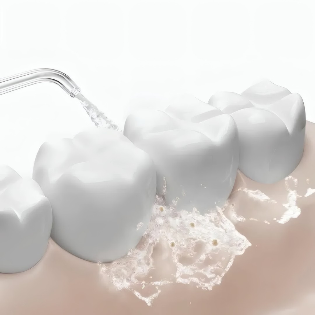 Ирригатор беспроводной Xiaomi Mijia Electric Flusher 2 (MEO705) Global